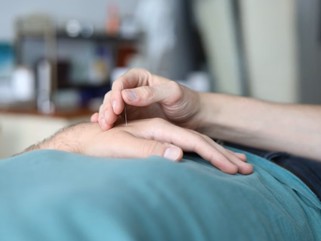 Acupuncture and Dry Needling in Physiotherapy